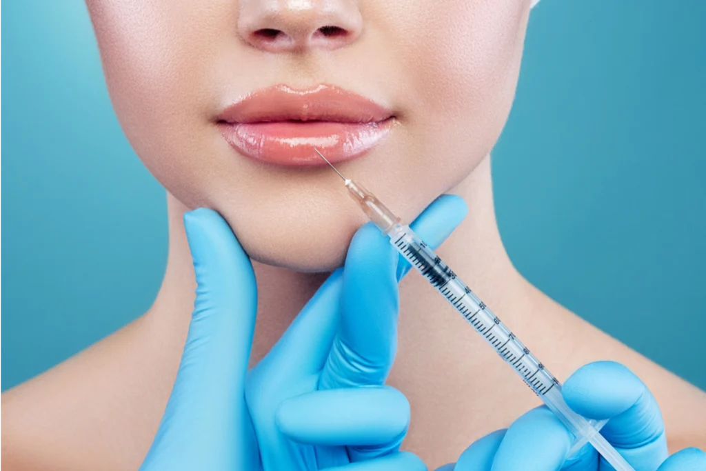 facetas dentárias