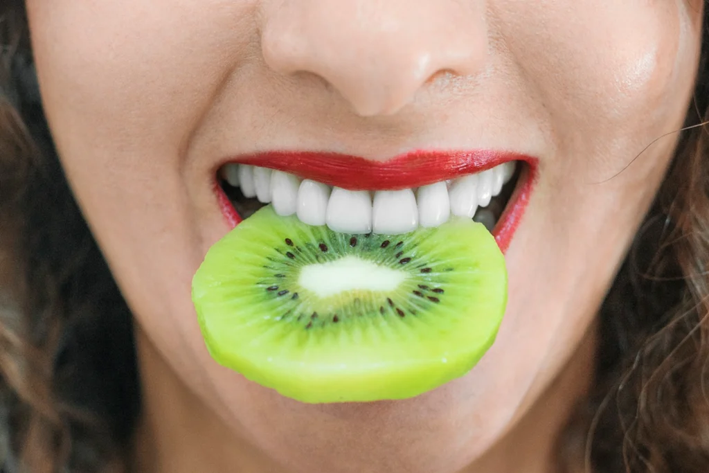 facetas dentárias