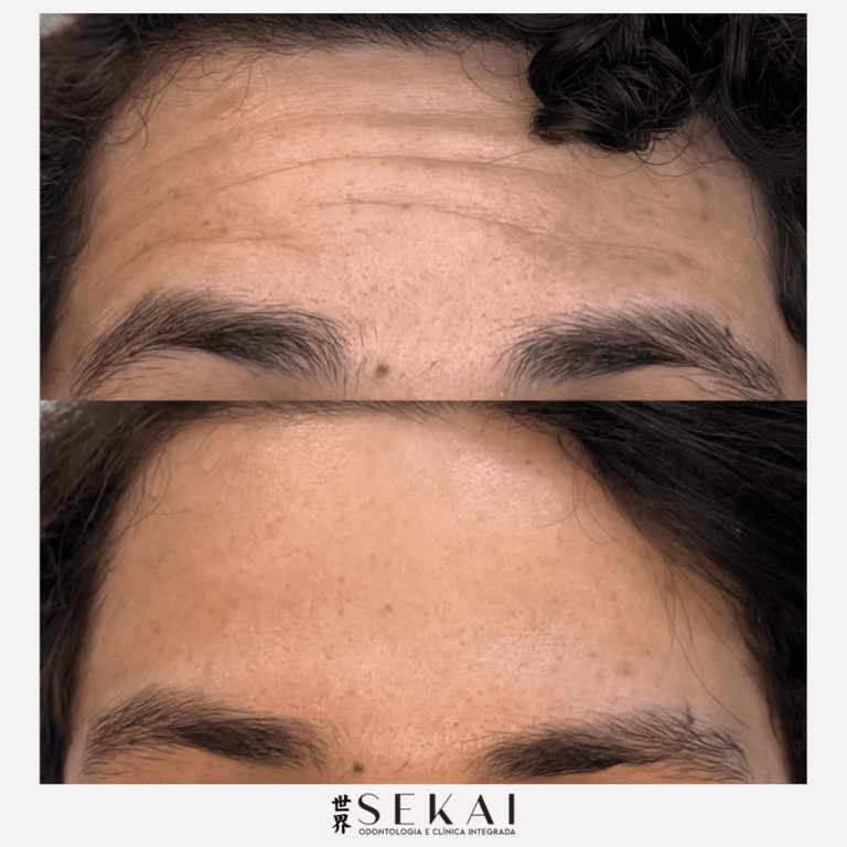 FOTOS PARA POST 2023 (3) (1)