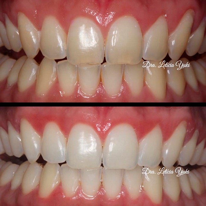 Caso 3: antes e depois