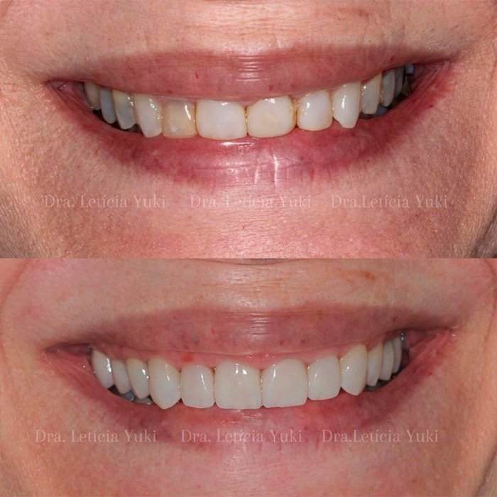 Caso 6: antes e depois