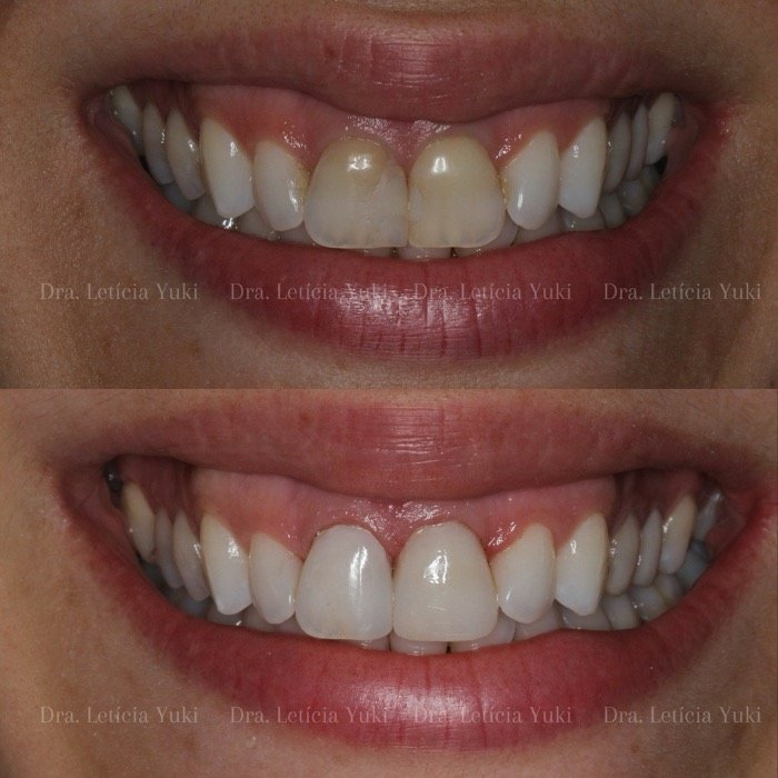 Caso 7: antes e depois