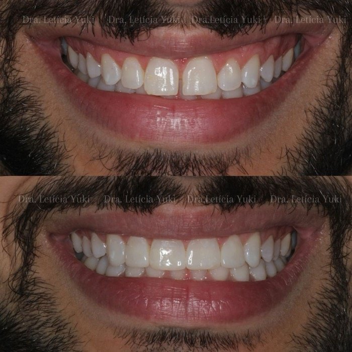 Caso 8: antes e depois