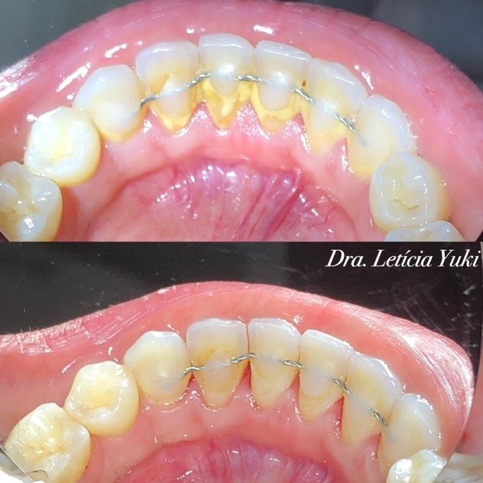 Caso 9: antes e depois