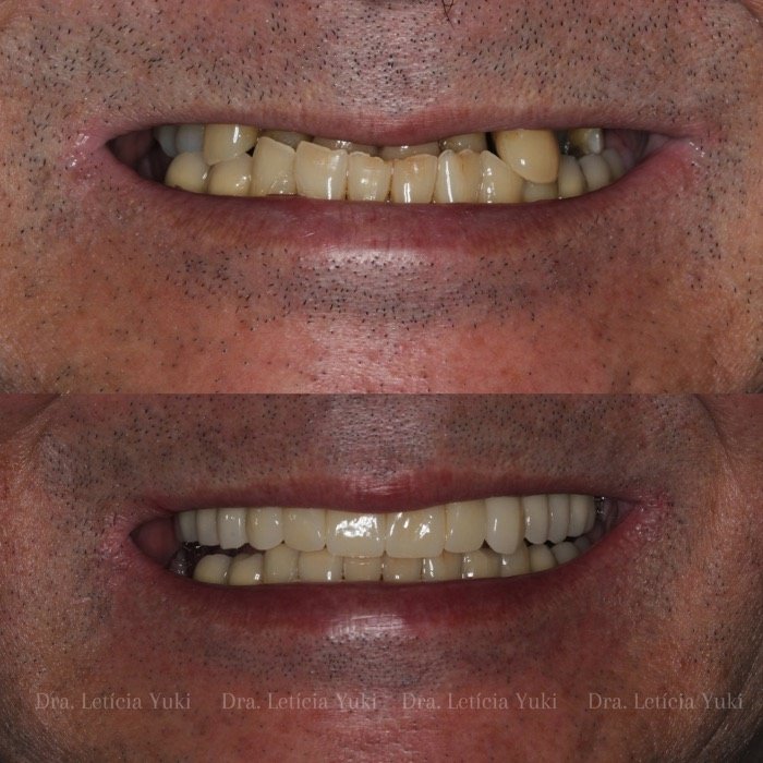 Caso 12: antes e depois